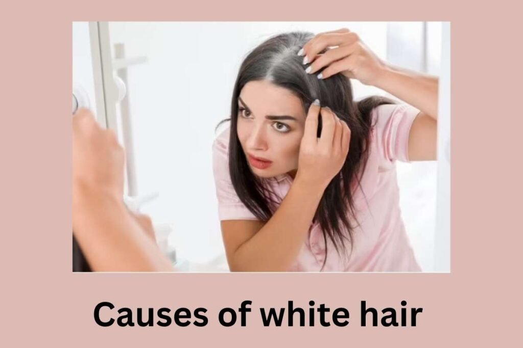 Causes of white hair